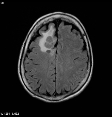 A close-up of a brain scan AI-generated content may be incorrect.