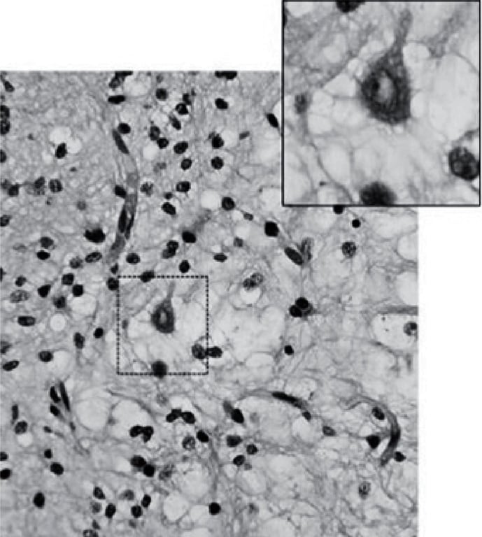 A close-up of a microscope AI-generated content may be incorrect.