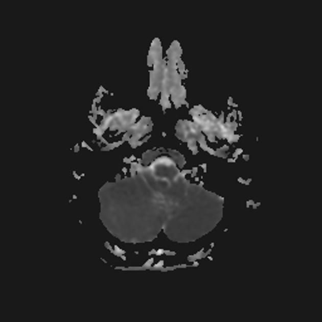 A close-up of a ct scan AI-generated content may be incorrect.