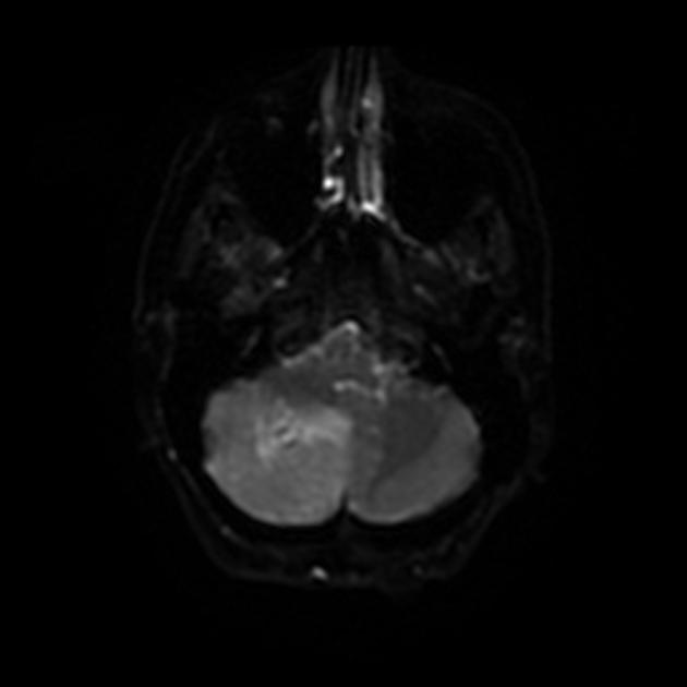 A mri of a brain AI-generated content may be incorrect.