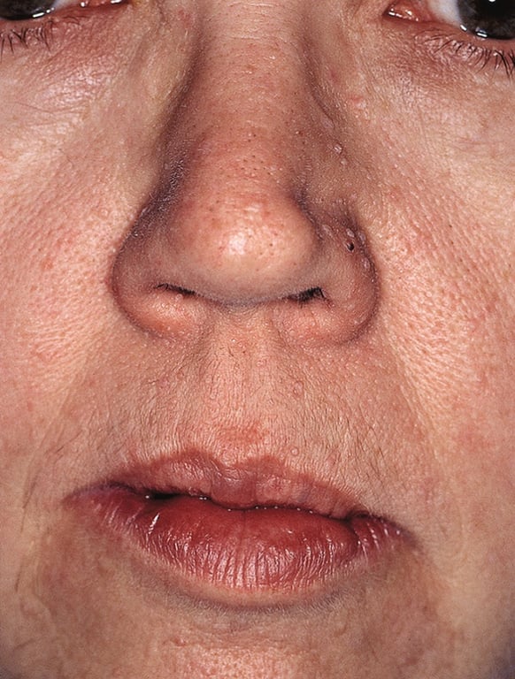 Close-up of a person's nose and mouth AI-generated content may be incorrect.