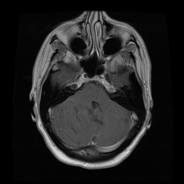 A close-up of a mri scan AI-generated content may be incorrect.