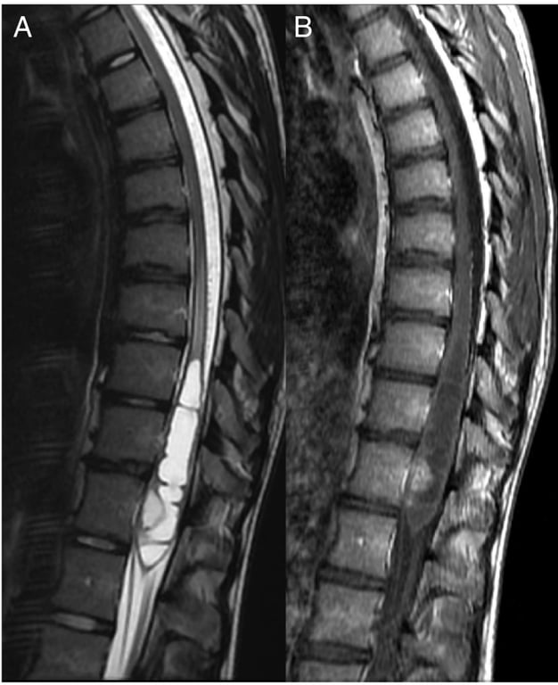 A close-up of a mri scan of a spine AI-generated content may be incorrect.