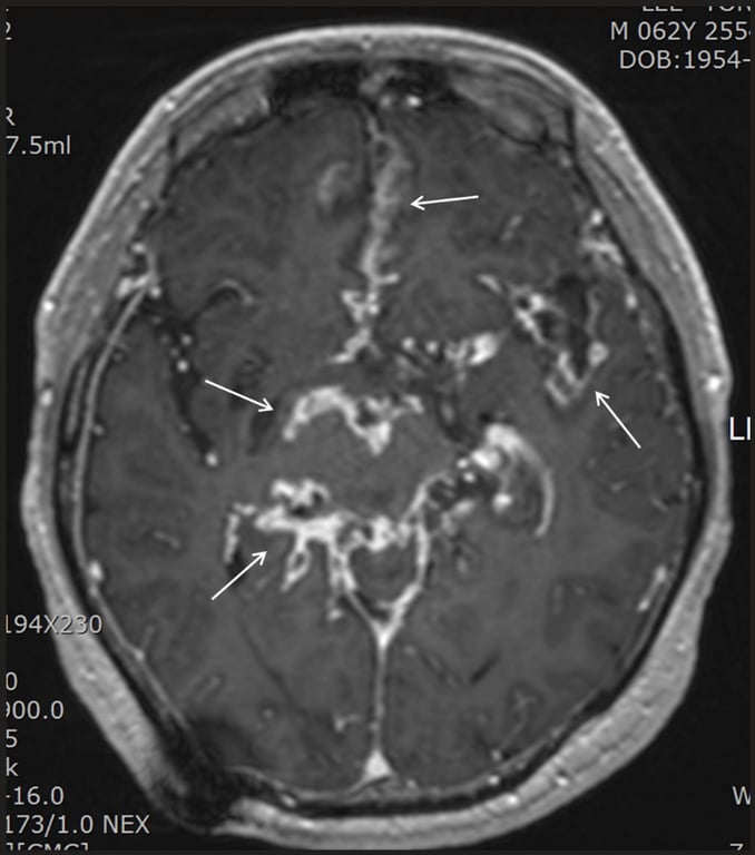 М 062У 255 DOB:1954 [94 „16.0 [73/1 „о МЕХ 