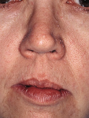 Close-up of a person's nose and mouth AI-generated content may be incorrect.