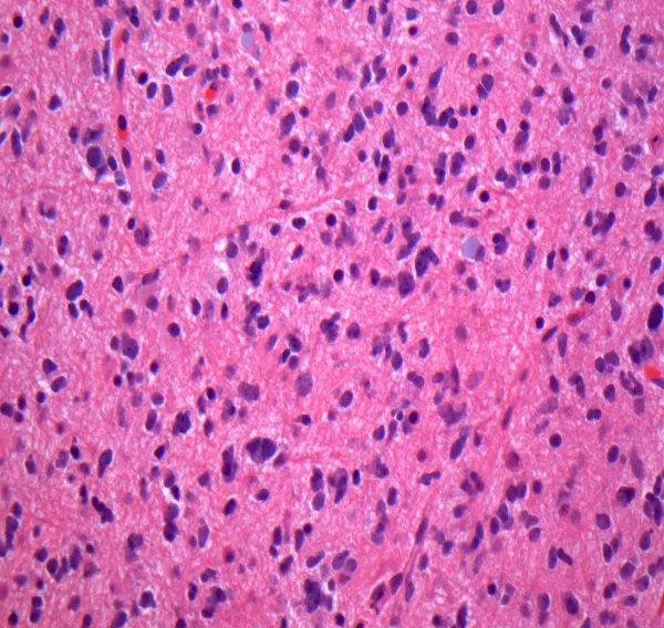 A pink and black cells under a microscope AI-generated content may be incorrect.