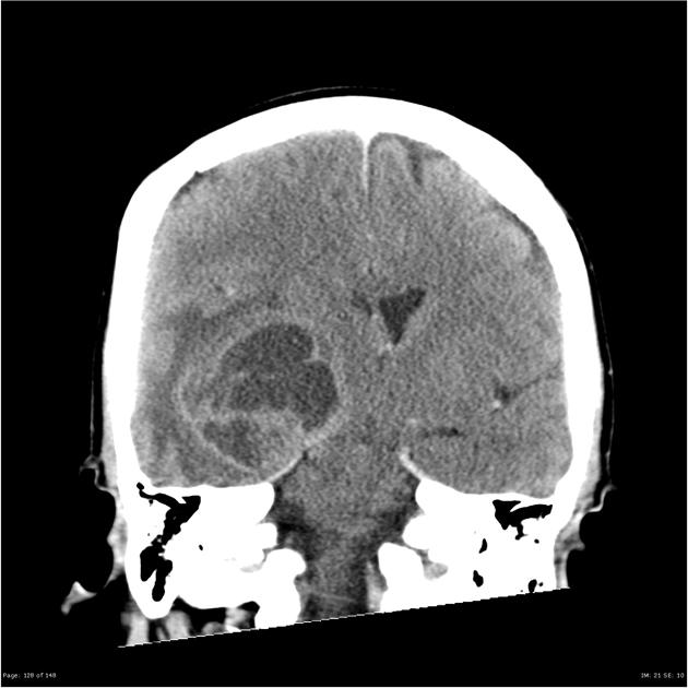 A close-up of a brain scan AI-generated content may be incorrect.