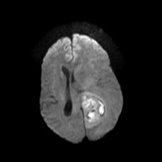 A brain scan of a baby AI-generated content may be incorrect.