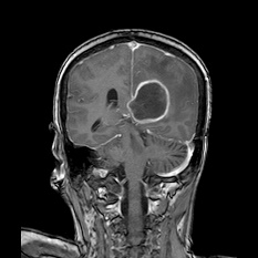 A close-up of a brain scan AI-generated content may be incorrect.