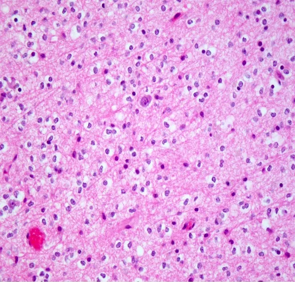 A close-up of a pink and black cell AI-generated content may be incorrect.