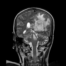 A close-up of a brain scan AI-generated content may be incorrect.