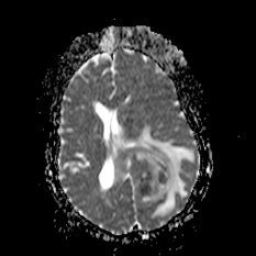 A close-up of a brain scan AI-generated content may be incorrect.