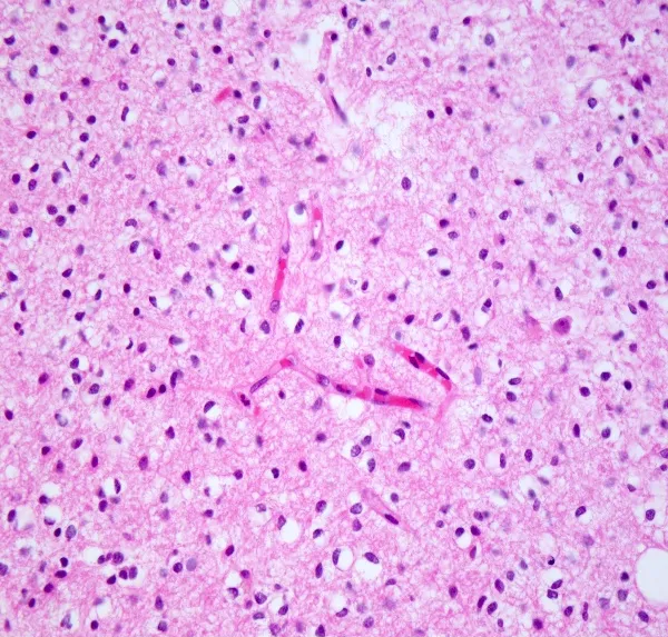 A microscope view of a cell AI-generated content may be incorrect.