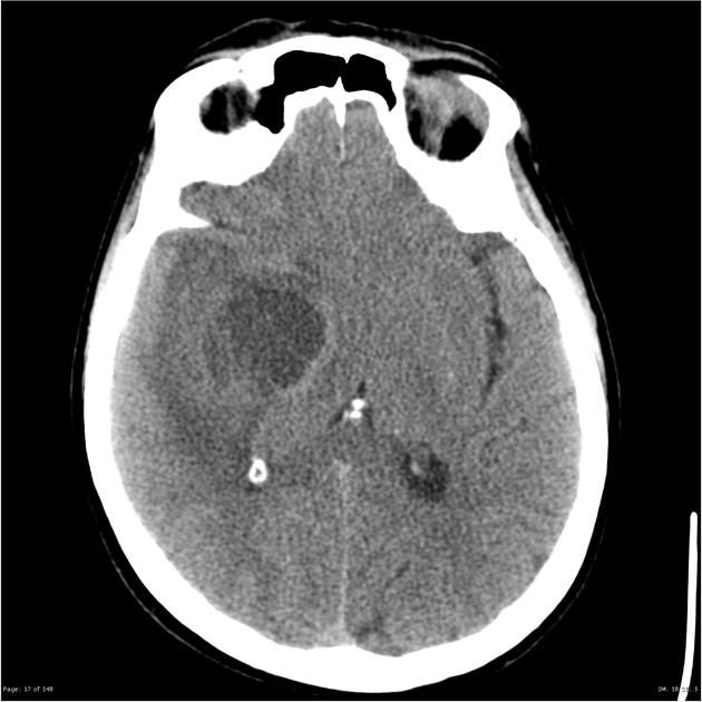 A close-up of a brain scan AI-generated content may be incorrect.