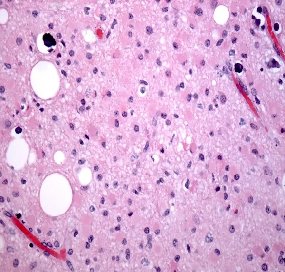A close-up of a microscope slide AI-generated content may be incorrect.