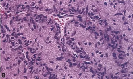 A close-up of a microscope AI-generated content may be incorrect.