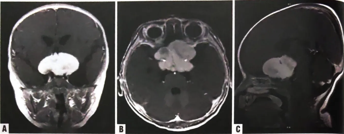 A close-up of a brain scan AI-generated content may be incorrect.