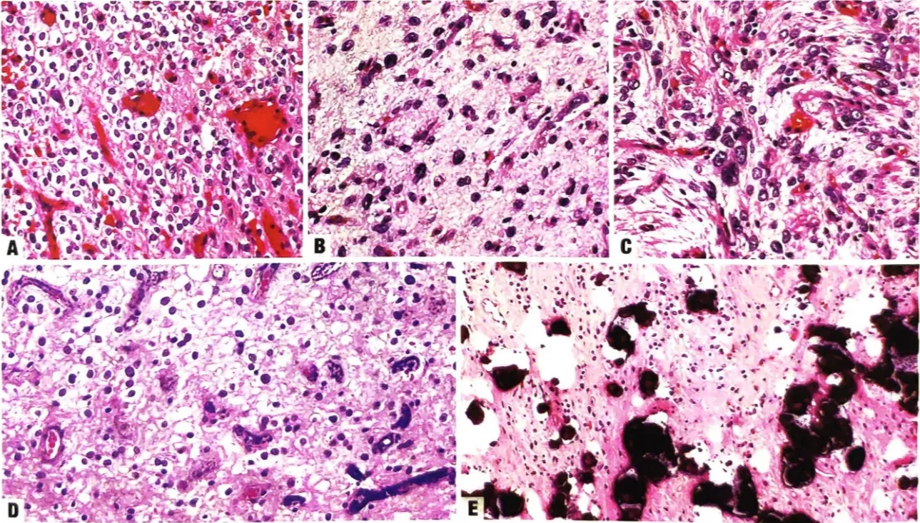 A collage of images of cells AI-generated content may be incorrect.