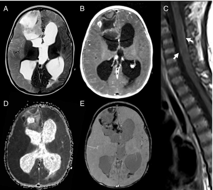 A close-up of a brain scan AI-generated content may be incorrect.