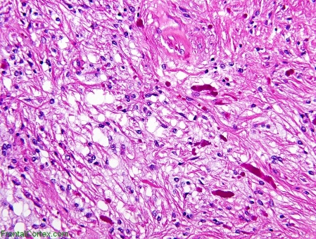 A microscope view of a pink and purple cell AI-generated content may be incorrect.