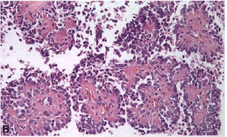 A close-up of a microscope AI-generated content may be incorrect.