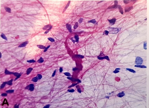 A close-up of a microscope AI-generated content may be incorrect.