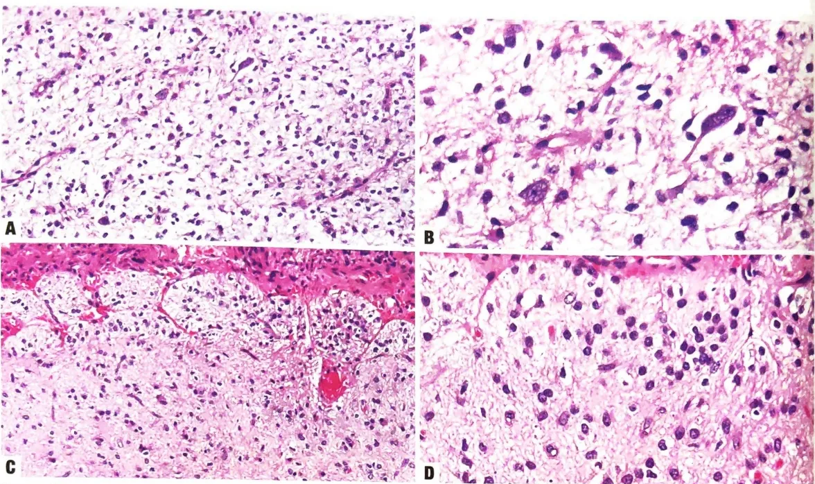 A collage of images of cells AI-generated content may be incorrect.