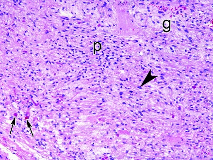 A microscope view of a cell AI-generated content may be incorrect.