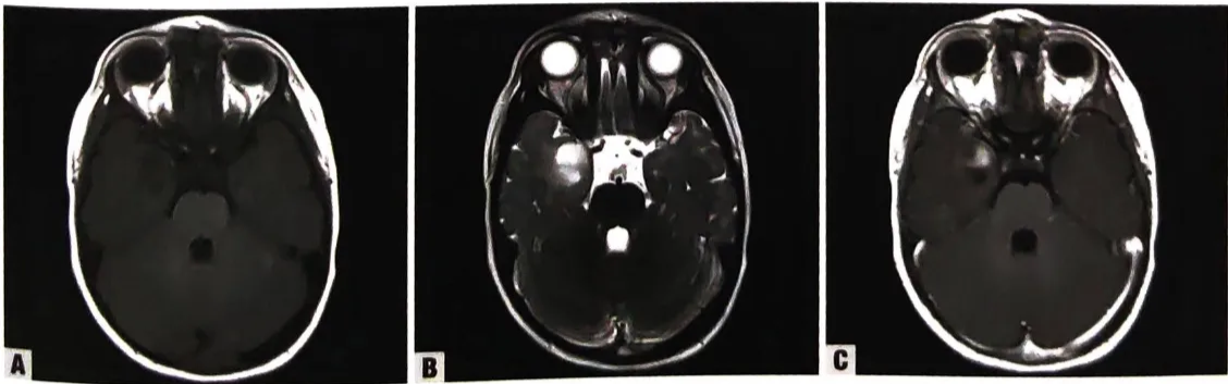 A close-up of a brain AI-generated content may be incorrect.