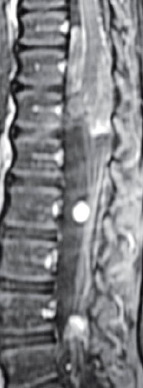 A close up of a buttoned shirt AI-generated content may be incorrect.