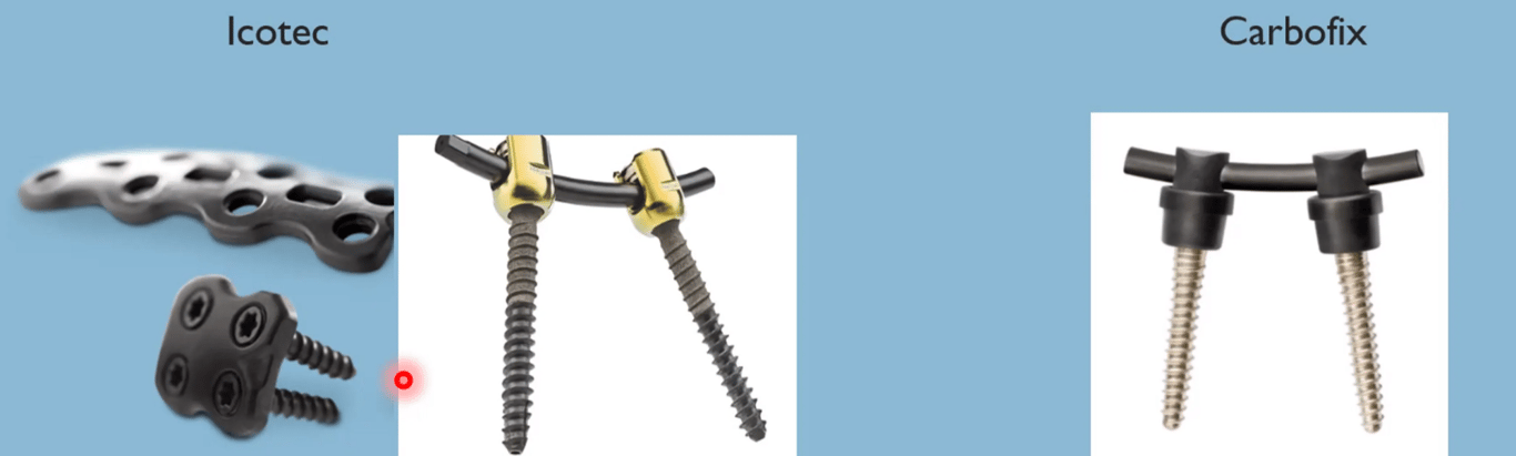 Carbon fibre composite pedicle screws and plates