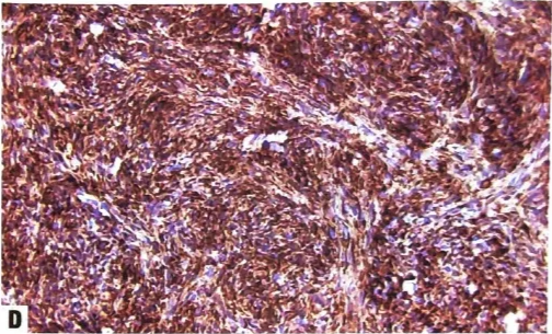 A close-up of a microscopic view of a human tissue AI-generated content may be incorrect.