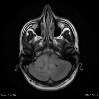 A close-up of a mri AI-generated content may be incorrect.