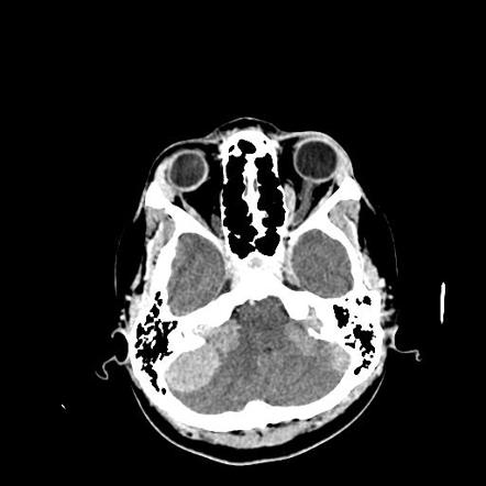 A close-up of a brain scan AI-generated content may be incorrect.