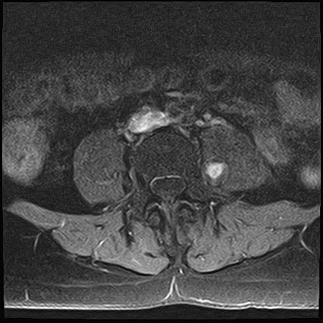 A close-up of an mri AI-generated content may be incorrect.