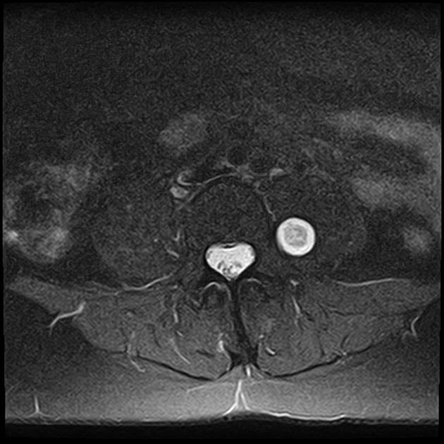 A close-up of an mri AI-generated content may be incorrect.
