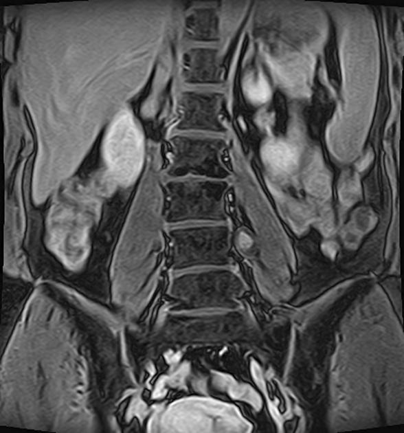 An x-ray of a spine AI-generated content may be incorrect.