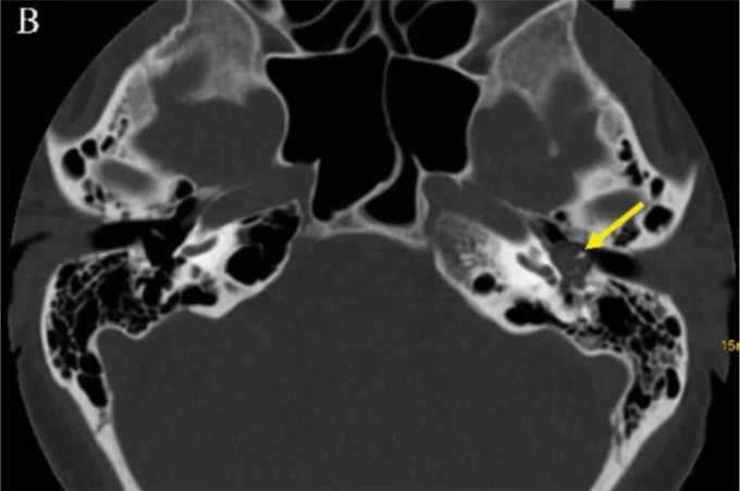 A close-up of a brain scan AI-generated content may be incorrect.