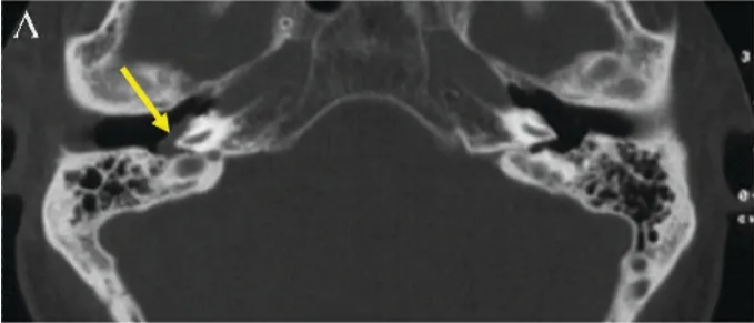 A close-up of a brain scan AI-generated content may be incorrect.