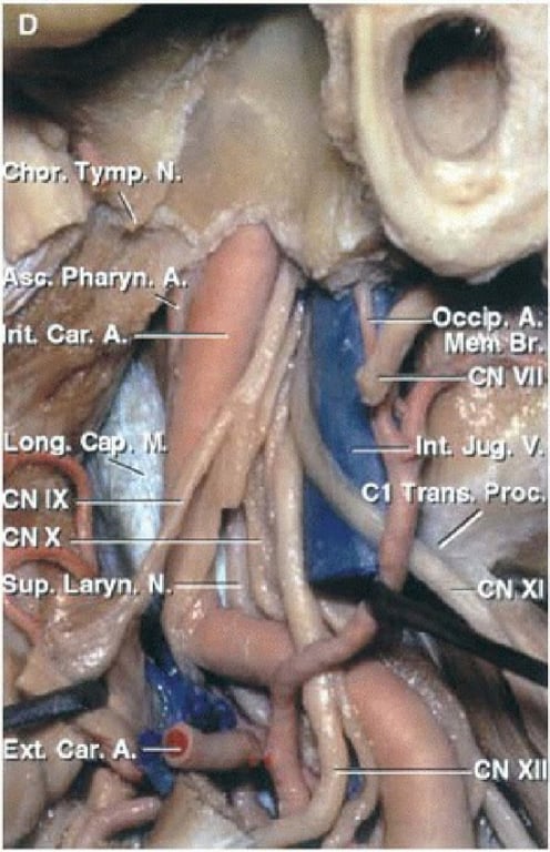 Tymp. rit car: Å. ong• Up.,LarypÅ xt*éår. A. Cl MetfrBr: nt ju*v. ran . roc. 