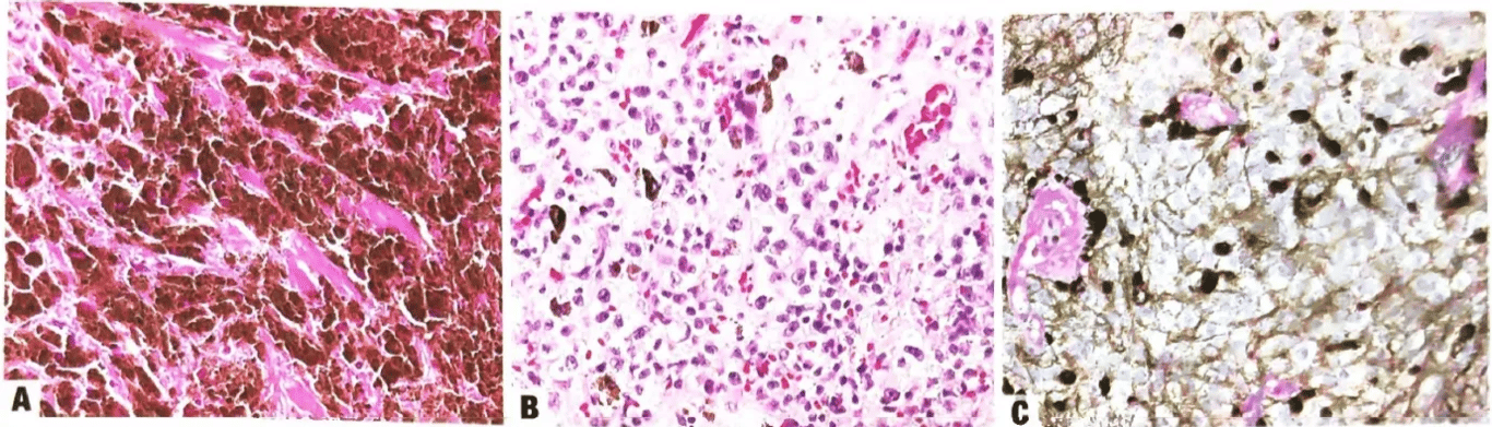 A close-up of a microscope AI-generated content may be incorrect.