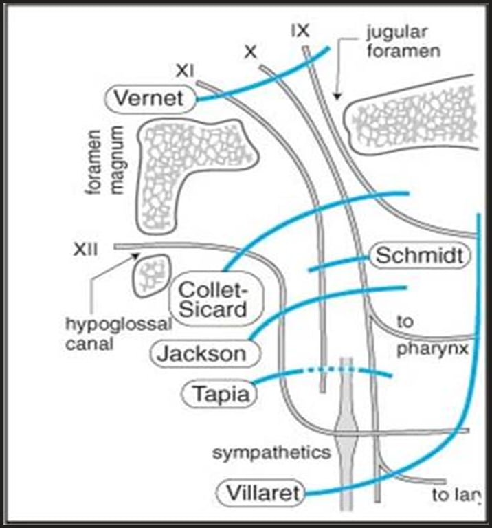 x Vernet Xll Collet- Sicard hypogl canal Jackson sympathetics Villare I jugular foramen Schmidt to arynx to Ian 