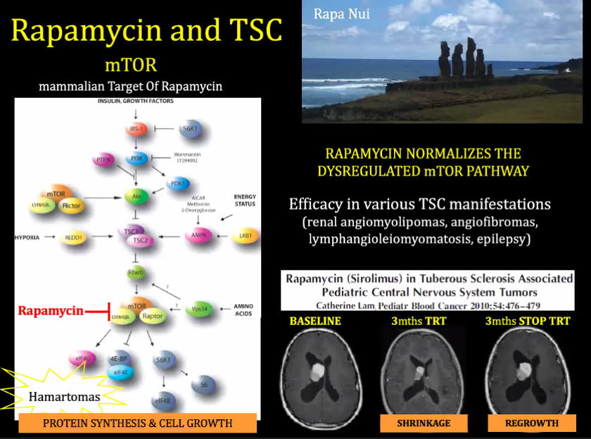 Rapa Nui Rapamycin and TSC mTOR mammalian Target Of Rapamycin F '.croes surus RAPAMYCIN NORMALIZES THE DYSREGULATED mTOR PATHWAY Efficacy in various TSC manifestations (renal angiomyolipomas, angiofibromas, lymphangioleiomyomatosis, epilepsy) Rapamycin (Sirolimus) in Tuberous Sclerosis Associated Pediatric Central Nervous System Tumors Catherine lam Rapamycin Hamartomas ROTEIN SYNTHESIS & CELL GR BASELINE 3mths TRT SHRINKAGE 3rnths srop TRT REGROWTH 