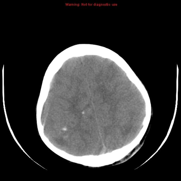 Warning: Not for diagnostic use 10 