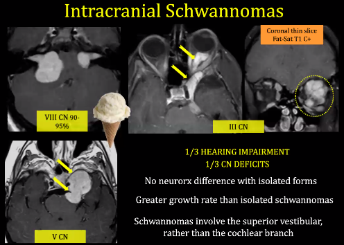 Intracranial Schwannomas Vill CN 90- Coronal thin slice Fat-Sat Tl C+ 1/3 HEARING IMPAIRMENT 1/3 CN DEFICITS No neurorx difference with isolated forms Greater growth rate than isolated schwannomas Schwannomas involve the superior vestibular, rather than the cochlear branch 