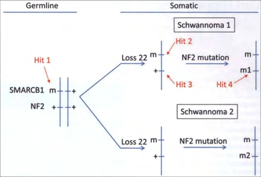 Germline Hit 1 SMARCBI m NF2 + Somatic Schwannoma 1 Hit 2 m NF2 mutation Loss 22 Hit 3 Hit 4 Schwannoma 2 NF2 mutation Loss 22 m Fig. 16.14 The four-hit mechanism for the formation of tumours in schwannomatosis. m ml m m2 