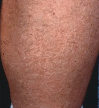 A close-up of a person's leg AI-generated content may be incorrect.