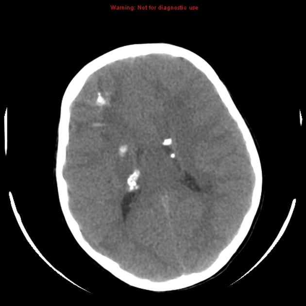 Warning: Not for diagnostic use 