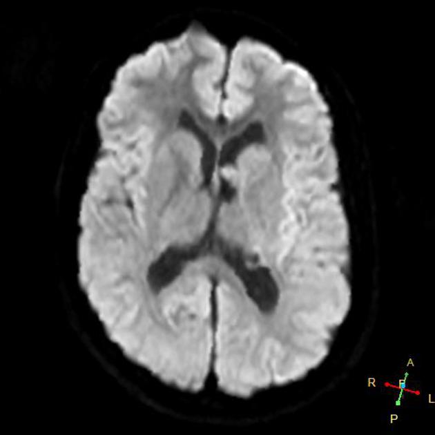 A close-up of a brain AI-generated content may be incorrect.