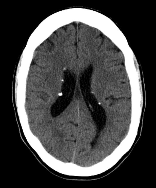 A close-up of a brain scan AI-generated content may be incorrect.